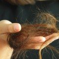 How long does it take for hair to grow back after losing weight?