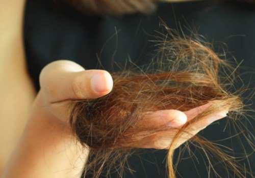 How long does hair loss last after weight loss?