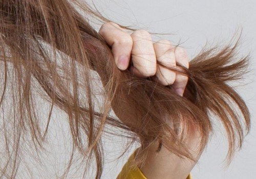 Is hair loss due to poor diet permanent?